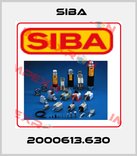 2000613.630 Siba