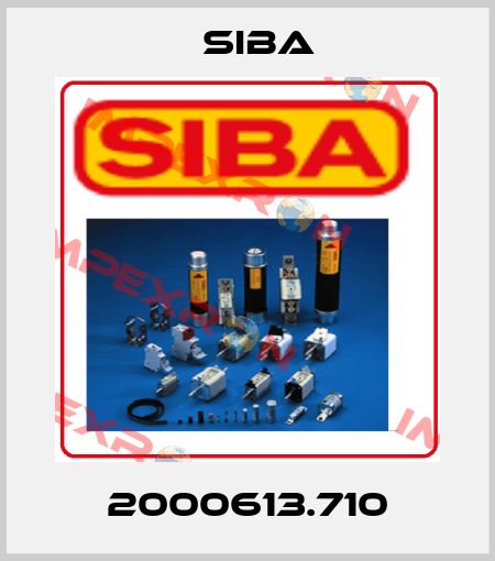 2000613.710 Siba